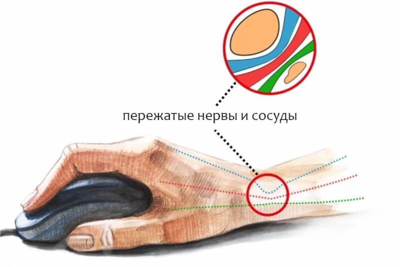 Кракен даркен